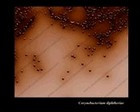 Corynebacterium diphtheriae on Tinsdale agar